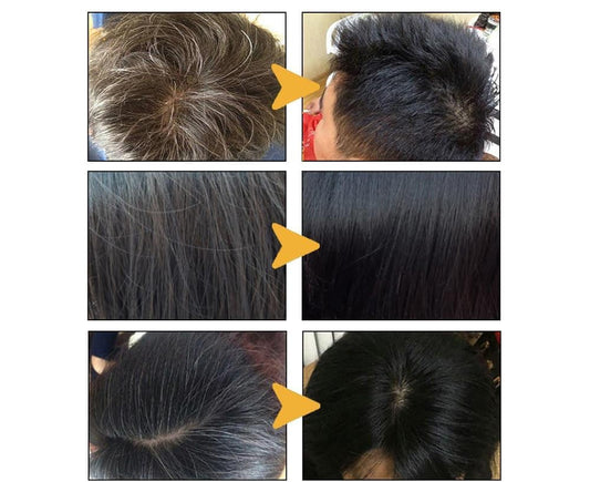 Shampooing Anti-Gris